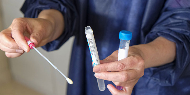 PCR Testi Nedir, Nasıl Yapılır? Genetik Hastalıklar, , Cinsel Yolla bulaşan Hastalıklar nelerdir? PCR testi ücretli mi?